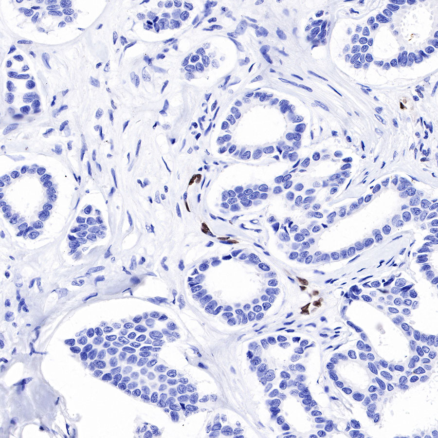 Rabbit anti-ERG Recombinant Monoclonal Antibody(190-65)