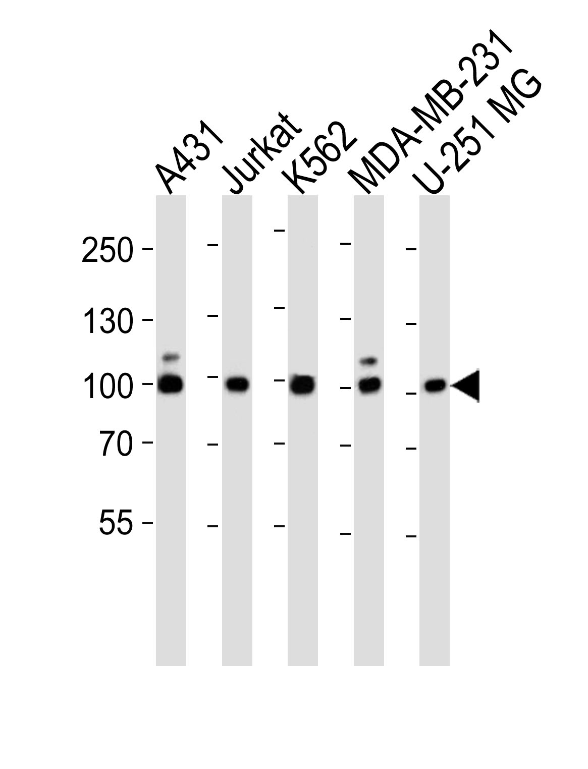 Rabbit anti-ZNF175 Polyclonal Antibody(N-term)