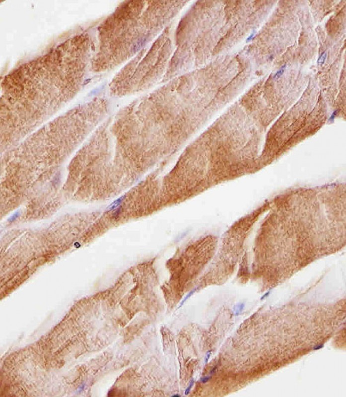 Mouse anti-Musk Monoclonal Antibody(1429CT456.173.44)