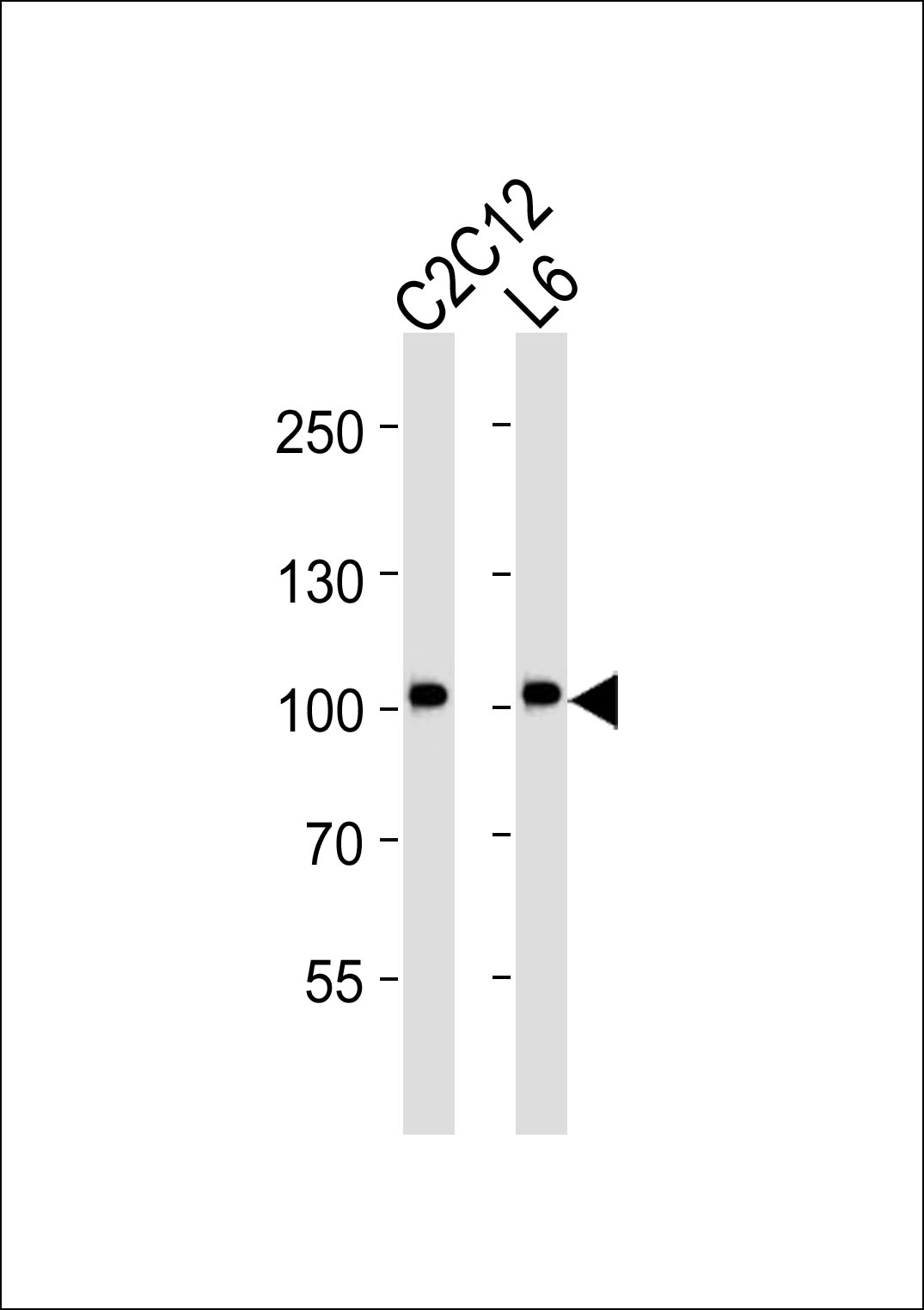Mouse anti-Musk Monoclonal Antibody(1429CT456.173.44)