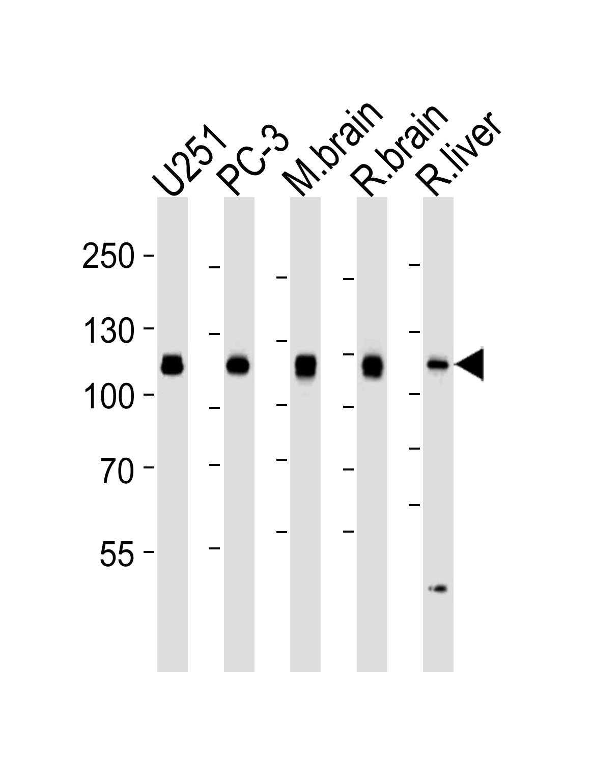 Mouse anti-USP5 Monoclonal Antibody(1340CT704.170.140)