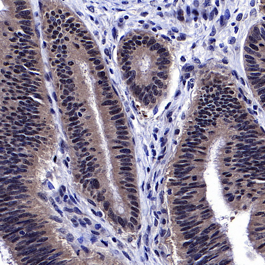 Rabbit anti-SMAD4 Recombinant Monoclonal Antibody(168-62)