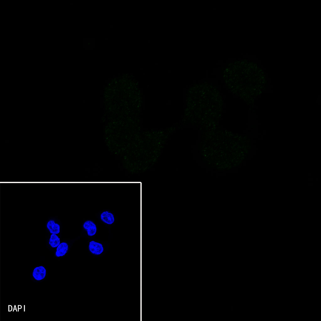 Rabbit anti-SMAD4 Recombinant Monoclonal Antibody(168-62)