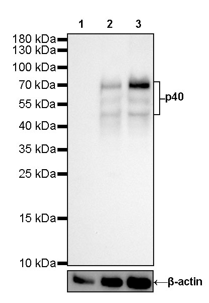 Rabbit anti-p40 Recombinant Monoclonal Antibody(166-36)