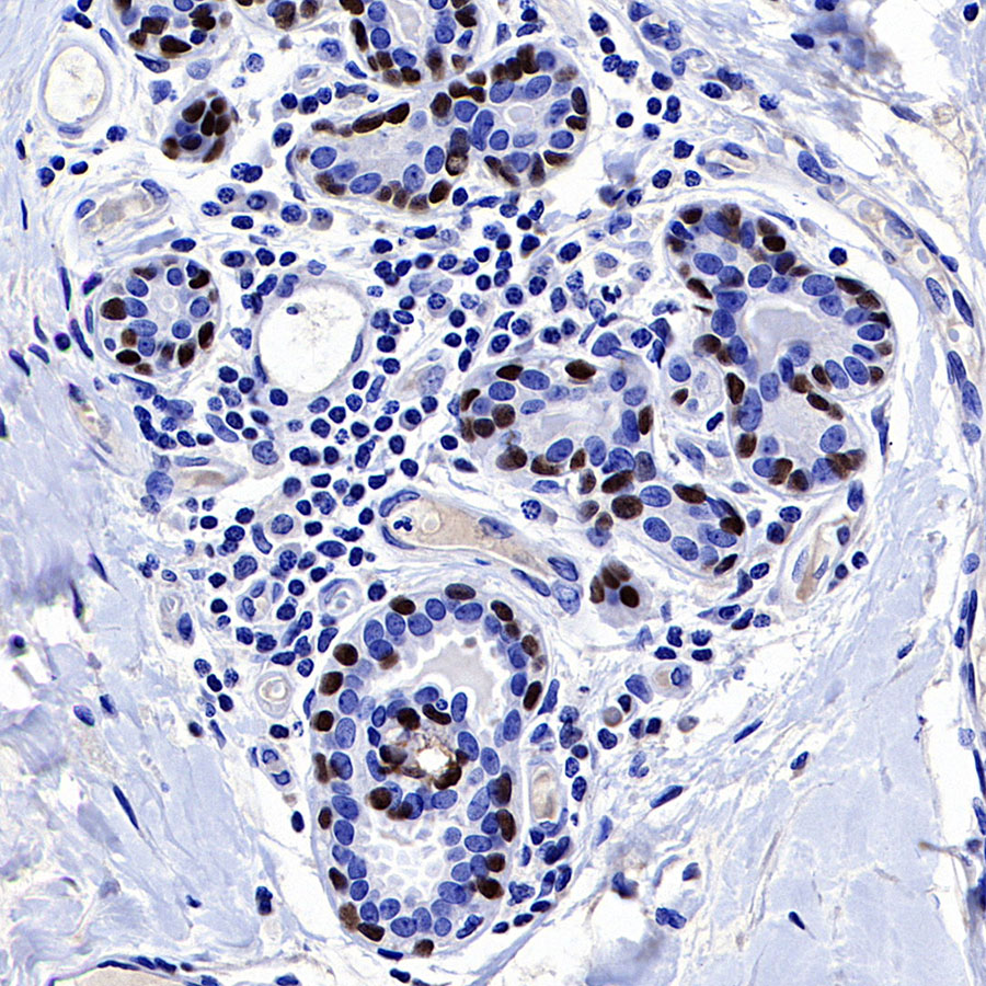 Rabbit anti-p40 Recombinant Monoclonal Antibody(166-36)