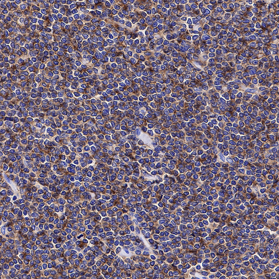 Rabbit anti-CD19 Recombinant Monoclonal Antibody(164-41)