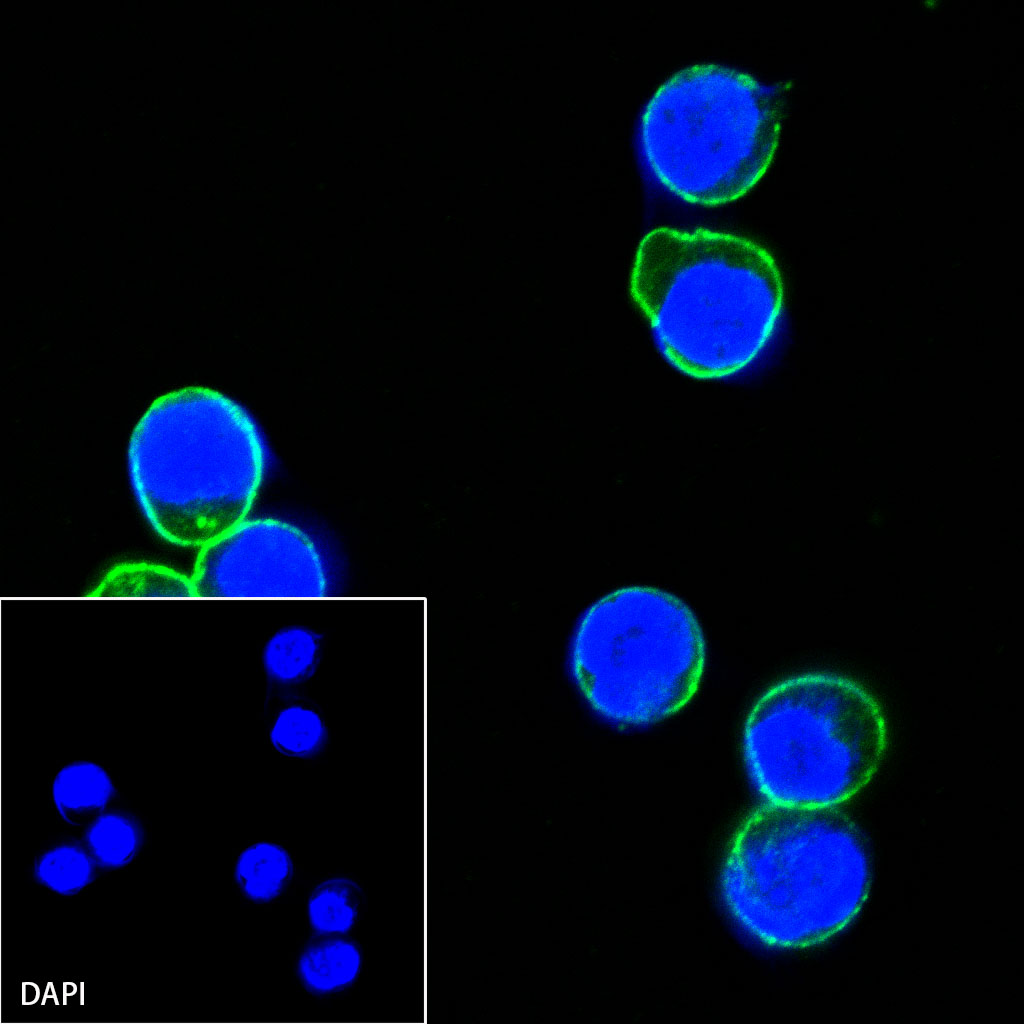 Rabbit anti-CD19 Recombinant Monoclonal Antibody(164-41)