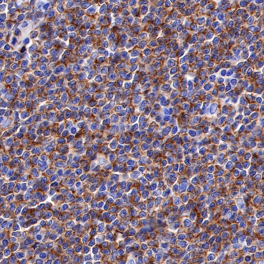Rabbit anti-CD19 Recombinant Monoclonal Antibody(164-33)