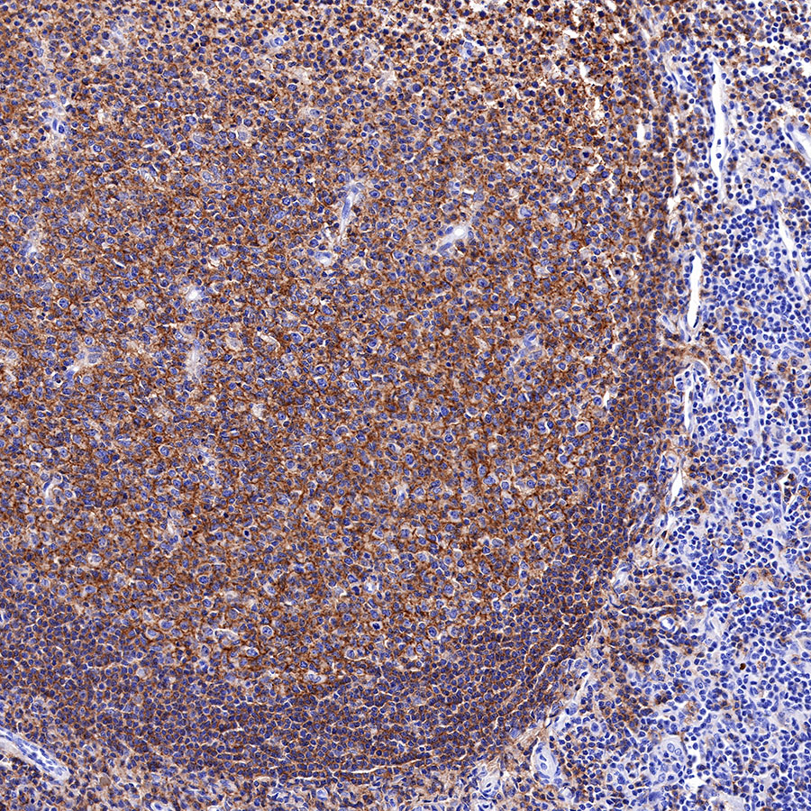 Rabbit anti-CD19 Recombinant Monoclonal Antibody(164-33)