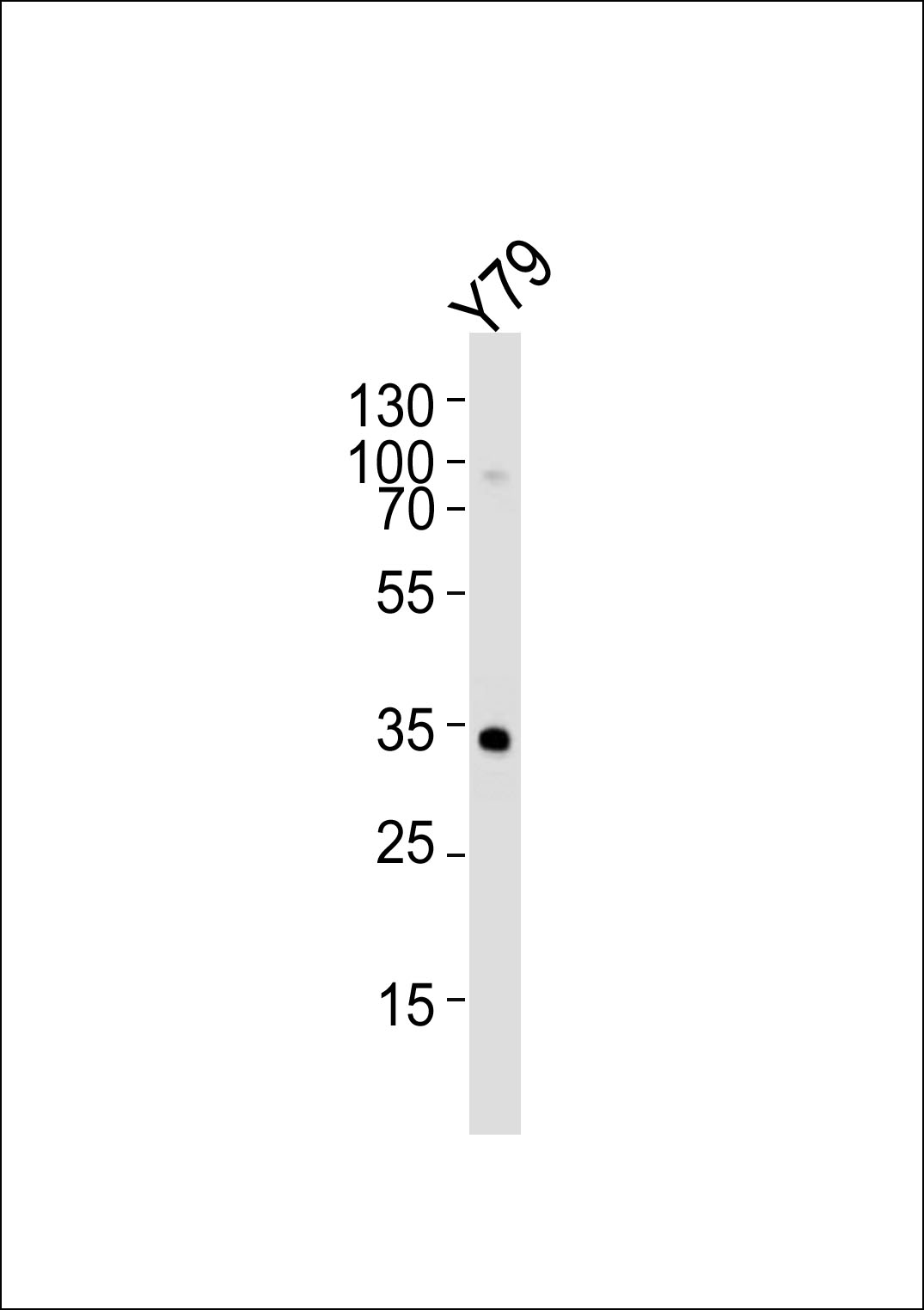 Mouse anti-OTX2 Monoclonal Antibody(1313CT817.185.162)