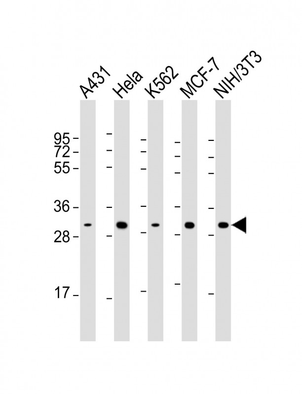 Mouse anti-CDK4 Monoclonal Antibody(1529CT850.162.73)