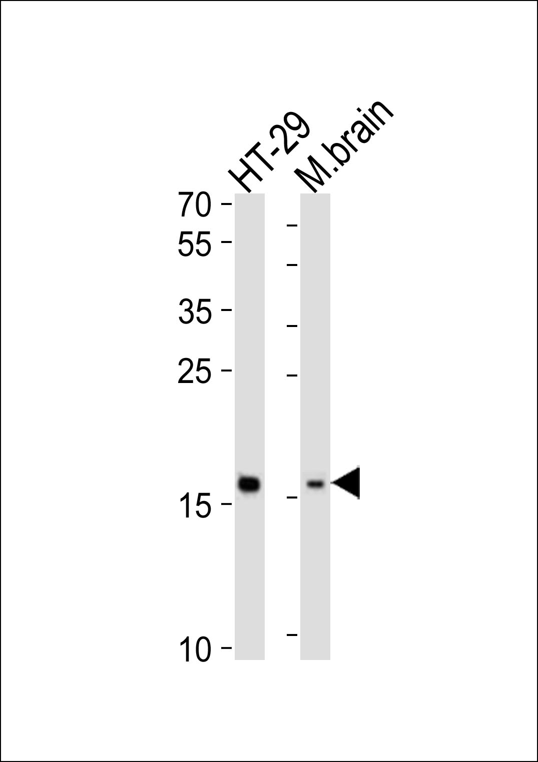 Rabbit anti-TMEM160 Polyclonal Antibody(N-term)