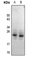 Rabbit anti-RGS1/8/16(pY187/159/168) Polyclonal Antibody
