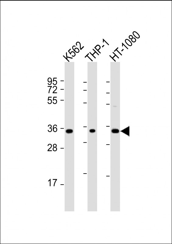 Rabbit anti-TMEM158 Polyclonal Antibody(C-Term)