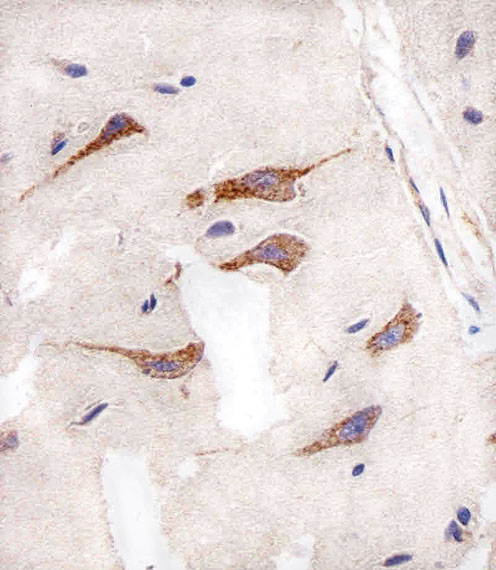 Mouse anti-AURKA Monoclonal Antibody(1364CT291.108.155)