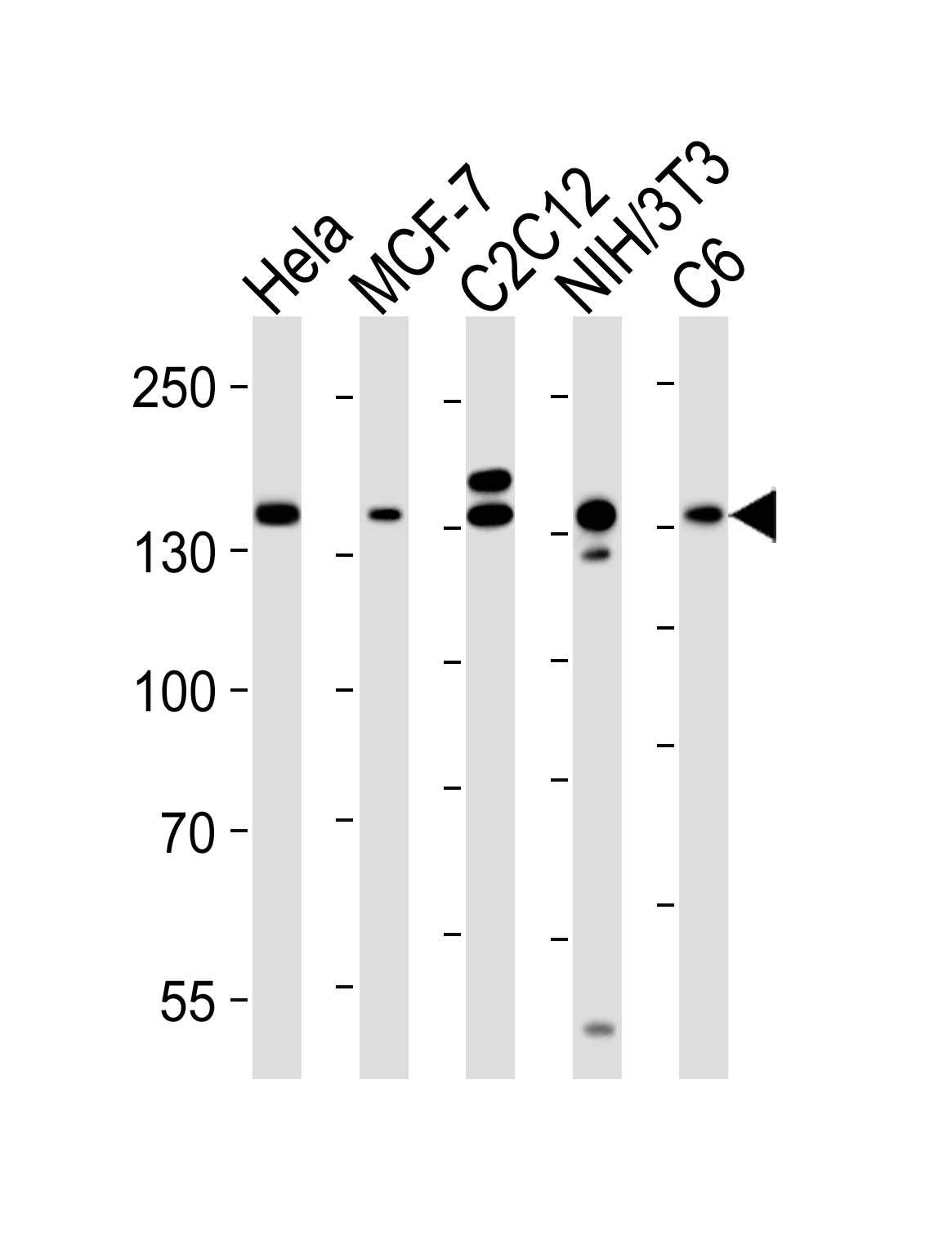 Mouse anti-RPTOR Monoclonal Antibody(1411CT316.2.151.34)