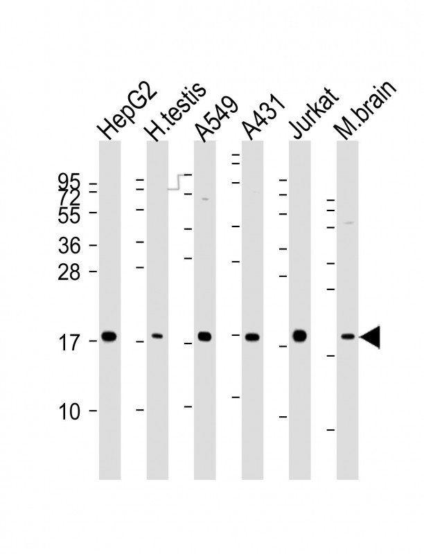 Mouse anti-EEF1E1 Monoclonal Antibody(1494CT639.147.31)