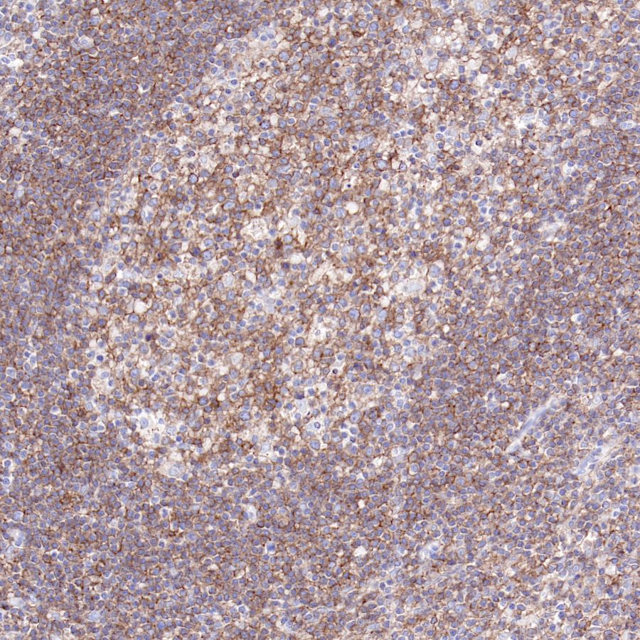 Rabbit anti-CD40 Recombinant Monoclonal Antibody(145-45)