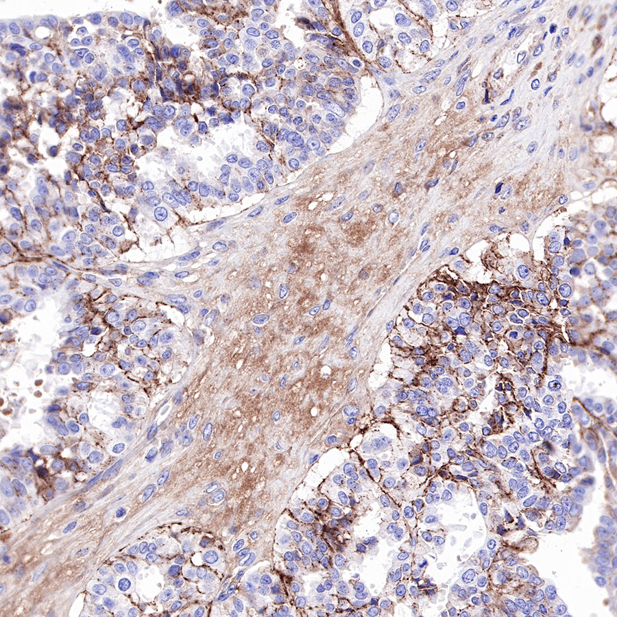 Rabbit anti-CD81 Recombinant Monoclonal Antibody(144-22)