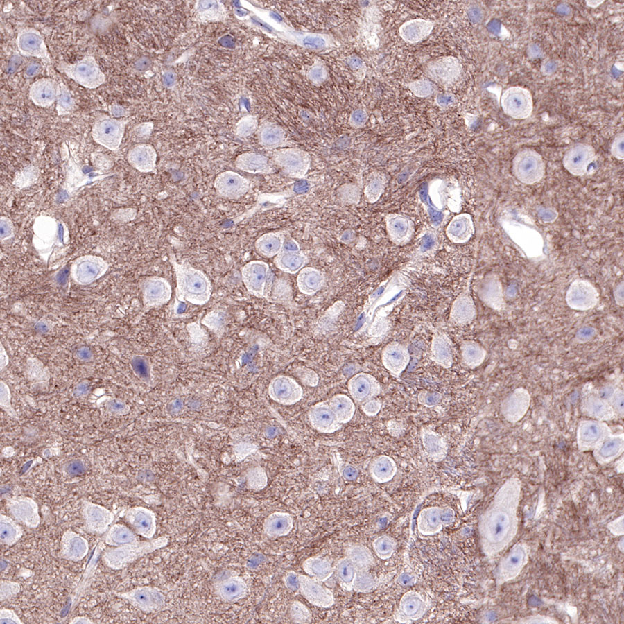 Rabbit anti-CD81 Recombinant Monoclonal Antibody(144-22)