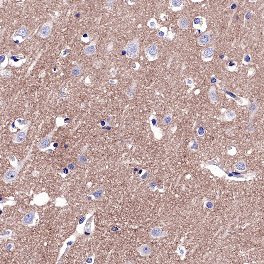 Rabbit anti-CD81 Recombinant Monoclonal Antibody(144-22)