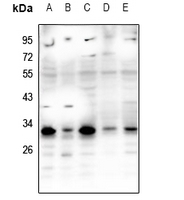 Rabbit anti-RNF138 Polyclonal Antibody