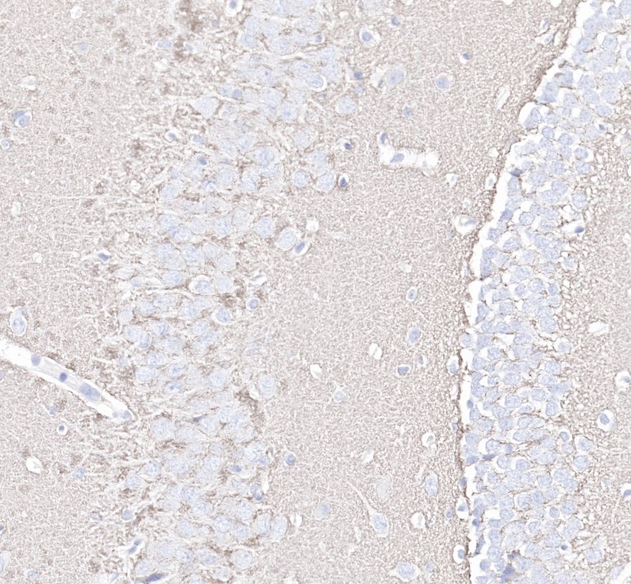 Rabbit anti-Synaptophysin Recombiant Monoclonal Antibody(137-21)