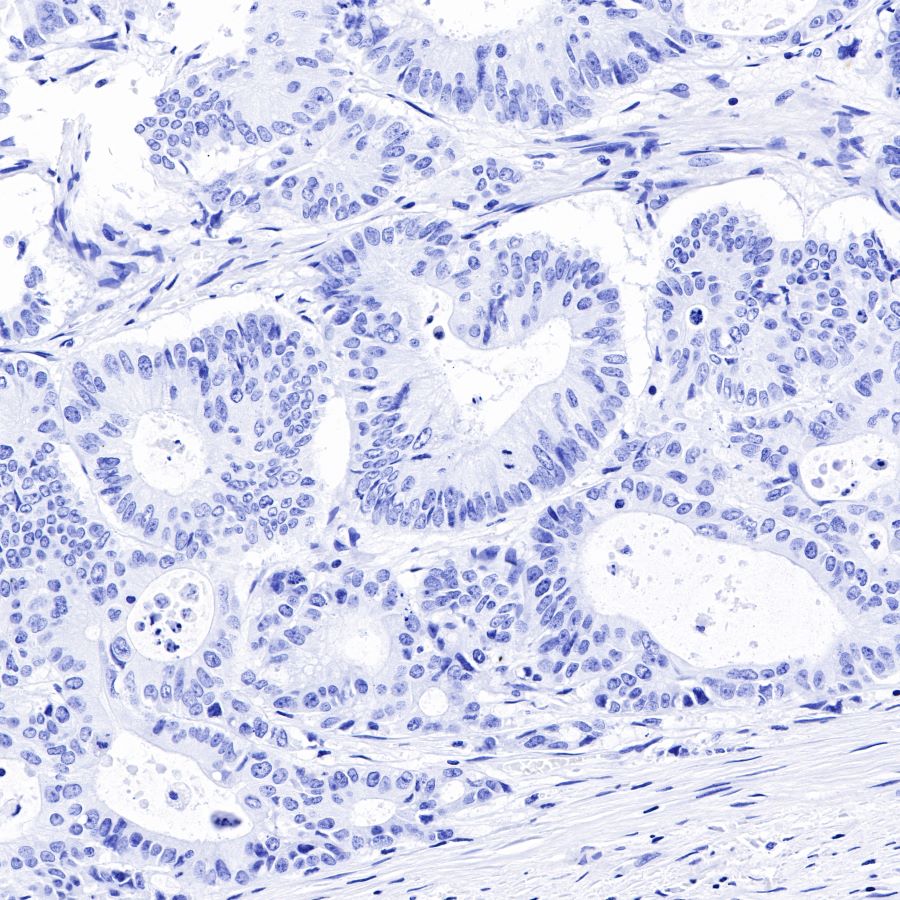 Rabbit anti-SOX-10 Recombinant Monoclonal Antibody(136-59)