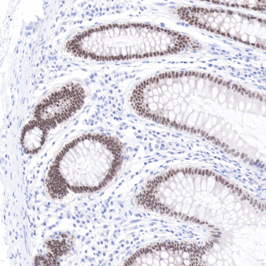 Rabbit anti-CDX2 Recombinant Monoclonal Antibody(134-76)
