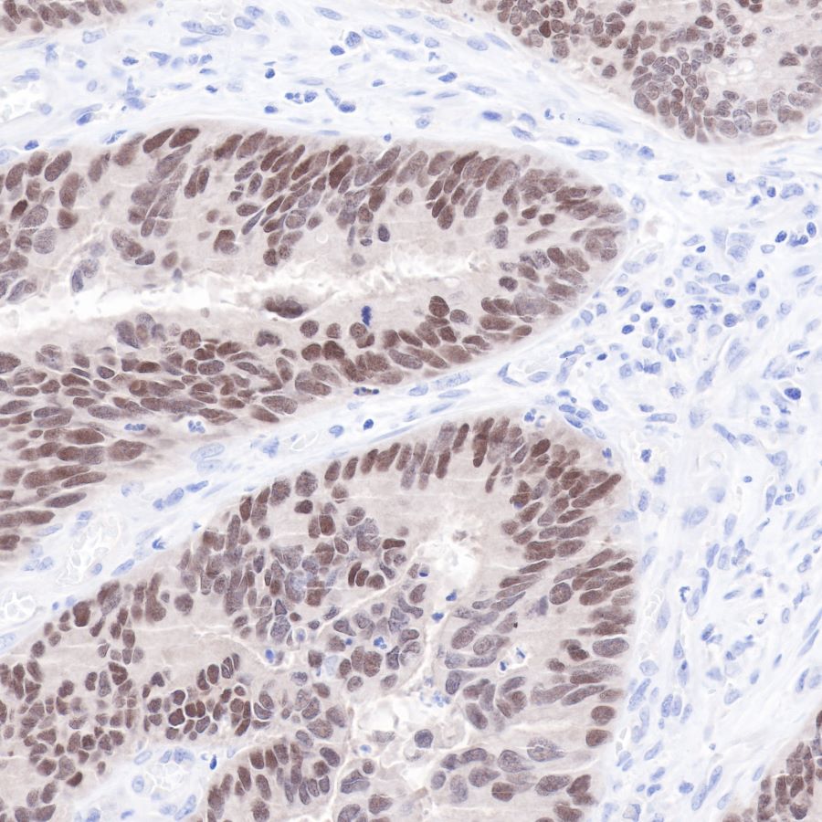 Rabbit anti-CDX2 Recombinant Monoclonal Antibody(134-76)