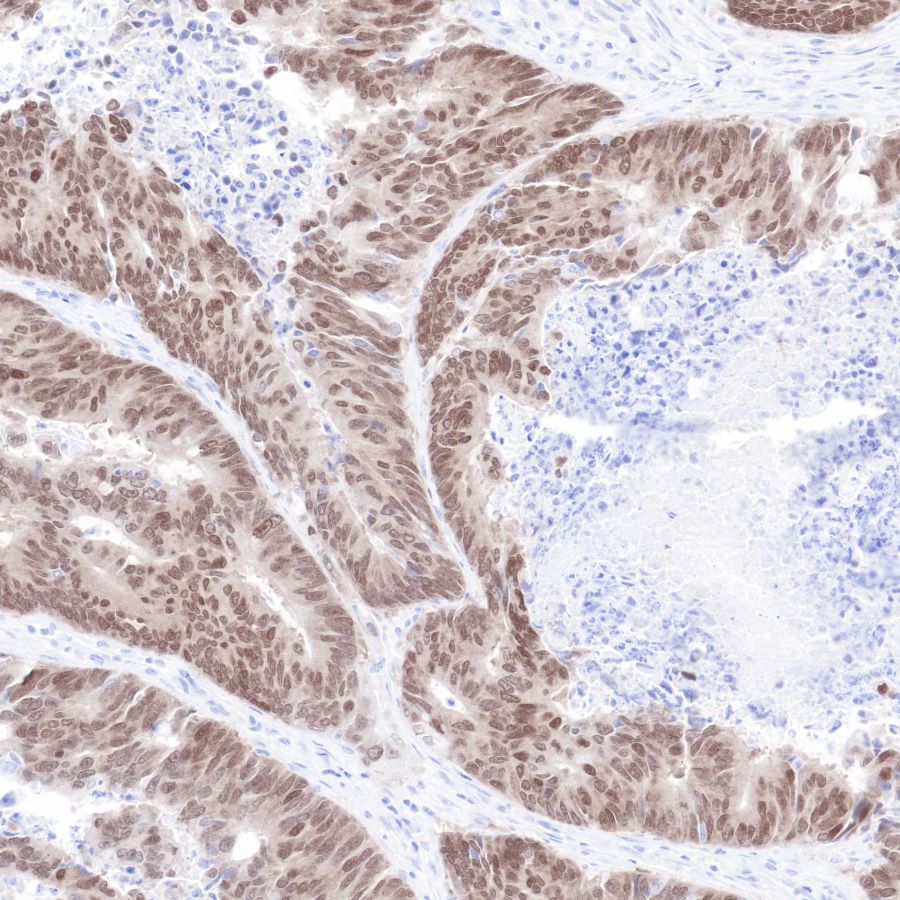 Rabbit anti-CDX2 Recombinant Monoclonal Antibody(134-76)