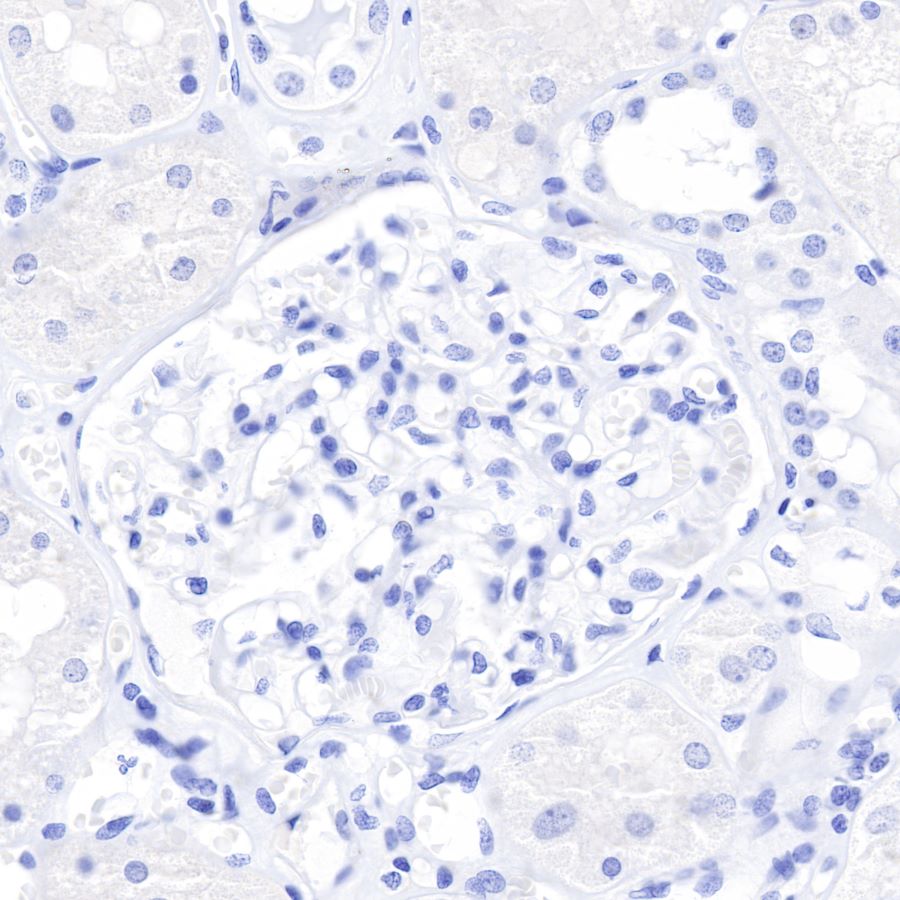 Rabbit anti-CDX2 Recombinant Monoclonal Antibody(134-76)