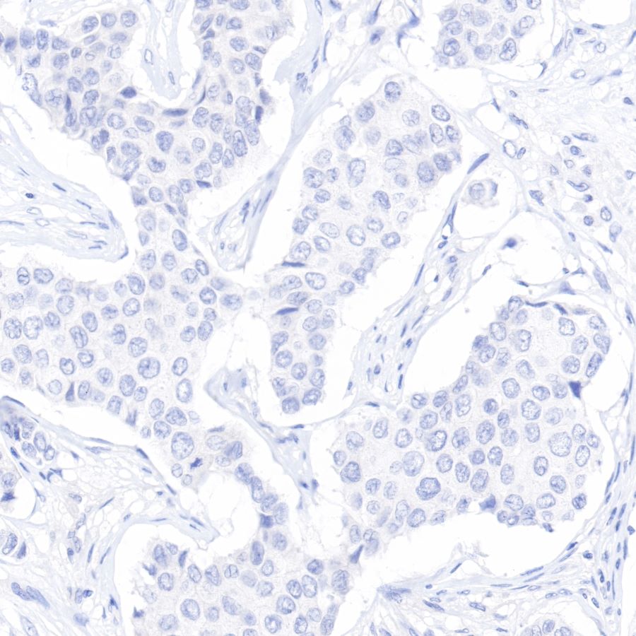 Rabbit anti-CDX2 Recombinant Monoclonal Antibody(134-76)