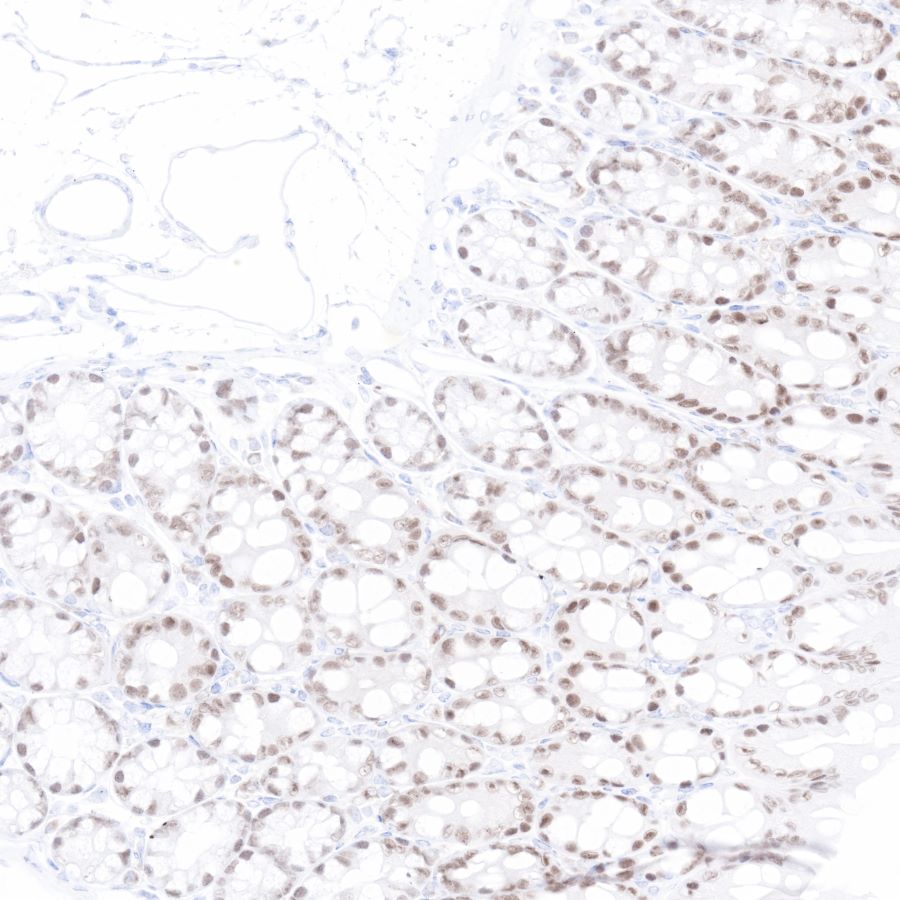 Rabbit anti-CDX2 Recombinant Monoclonal Antibody(134-76)