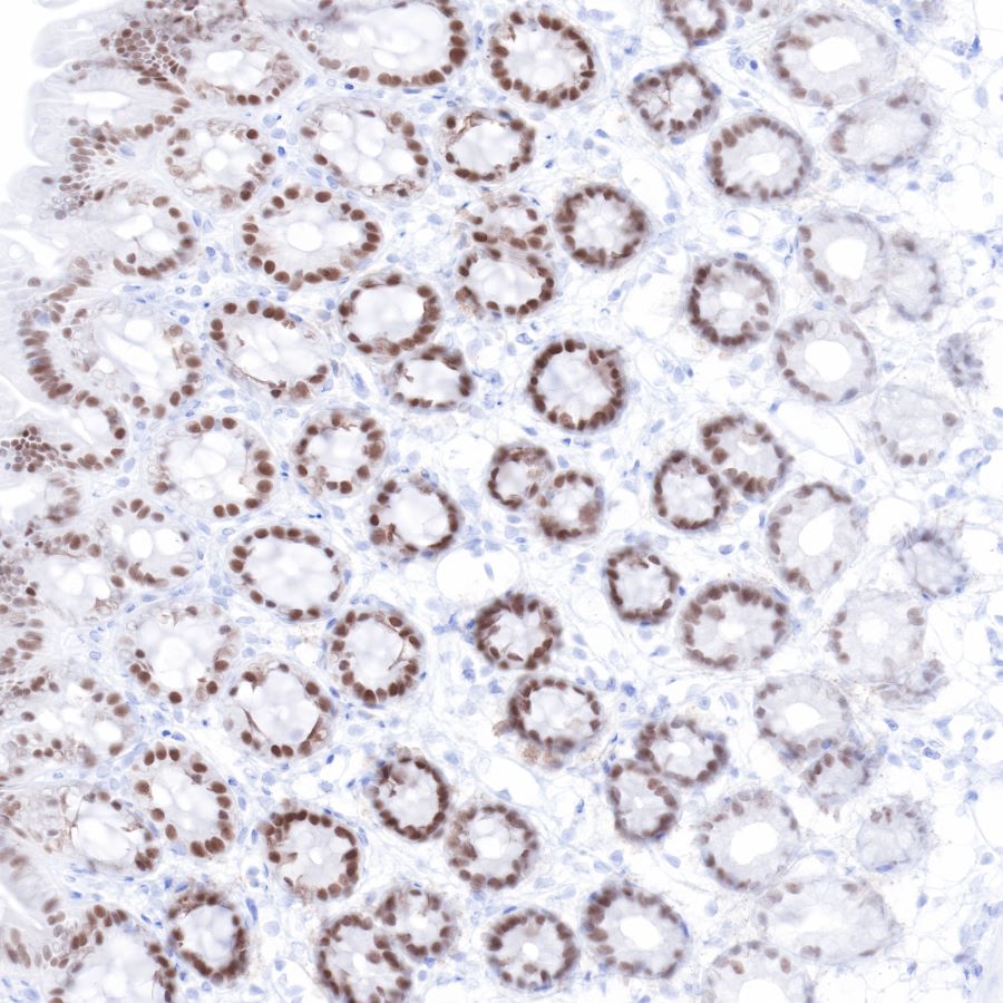 Rabbit anti-CDX2 Recombinant Monoclonal Antibody(134-76)