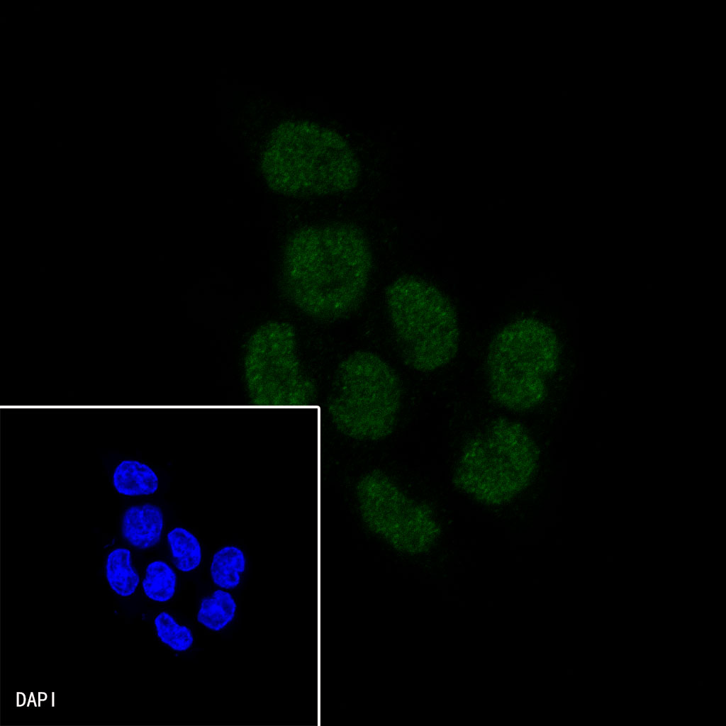 Rabbit anti-CDX2 Recombinant Monoclonal Antibody(134-76)