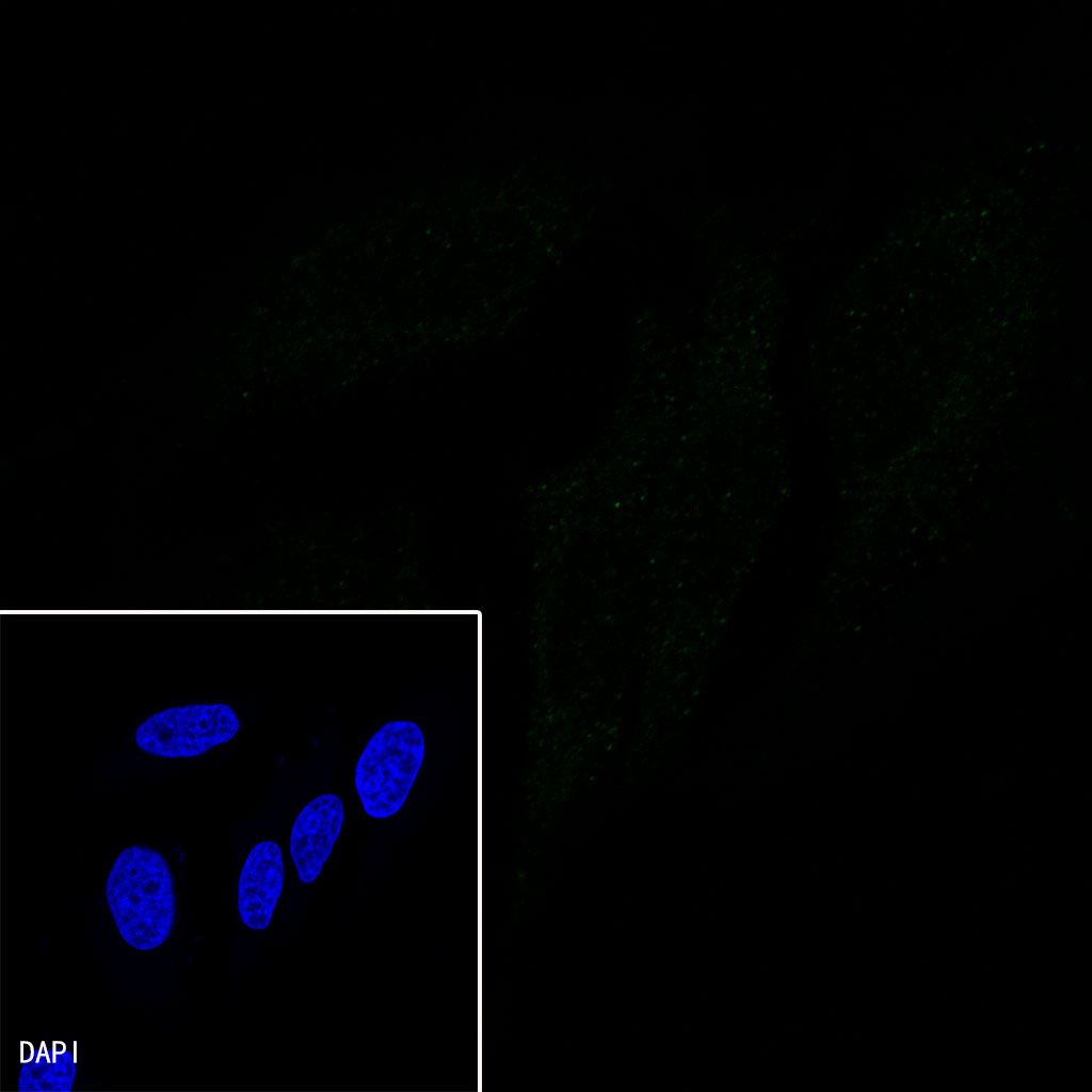 Rabbit anti-CDX2 Recombinant Monoclonal Antibody(134-76)
