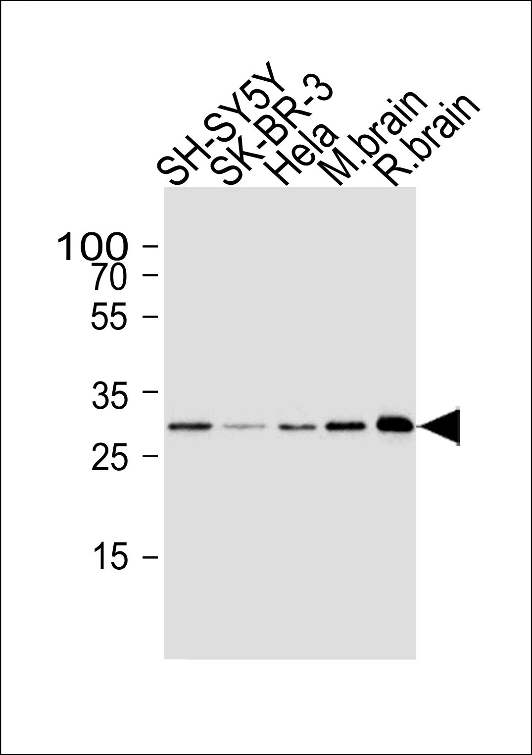 Mouse anti-CDK5 Monoclonal Antibody(1321CT281.130.129)