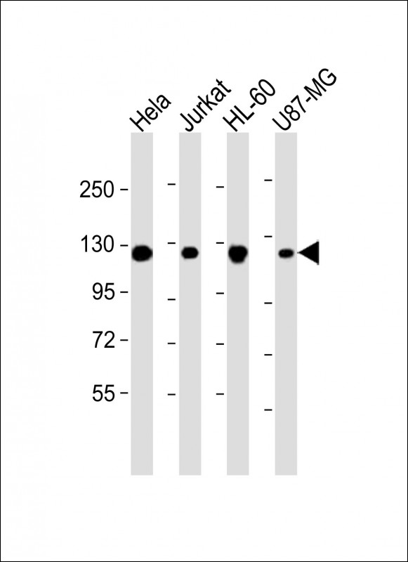 Mouse anti-RNF20 Monoclonal Antibody(1594CT552.128.36)