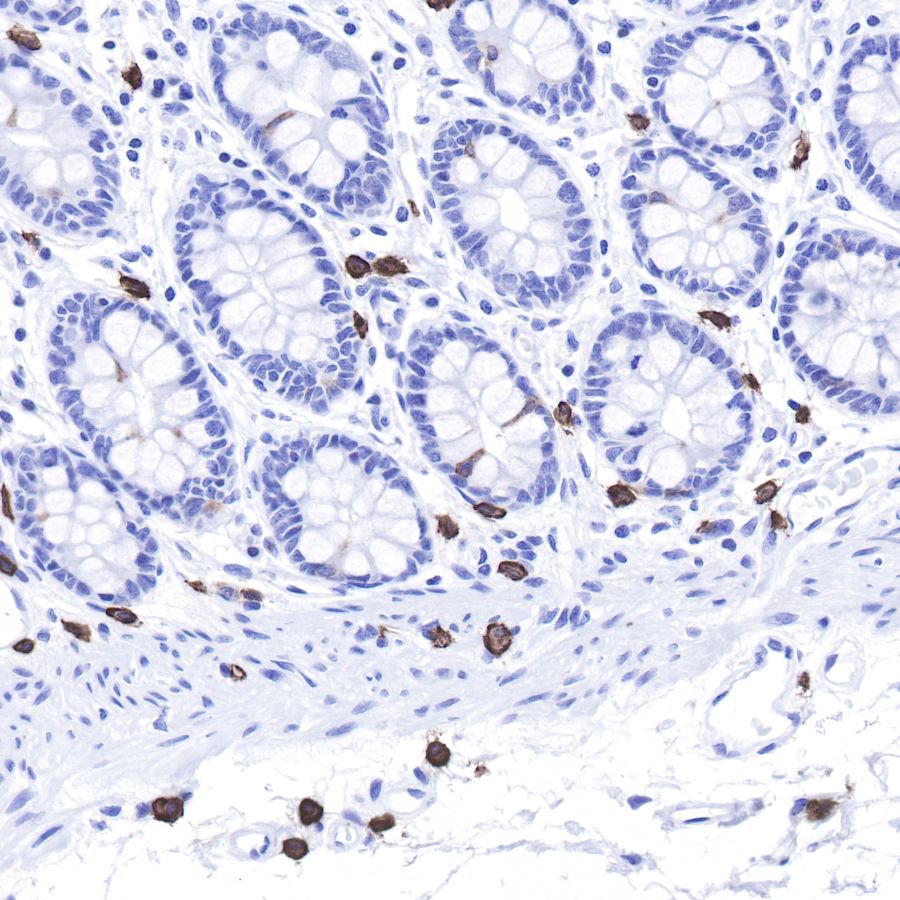 Rabbit anti-CD117 Recombinant Monoclonal Antibody(125-51)