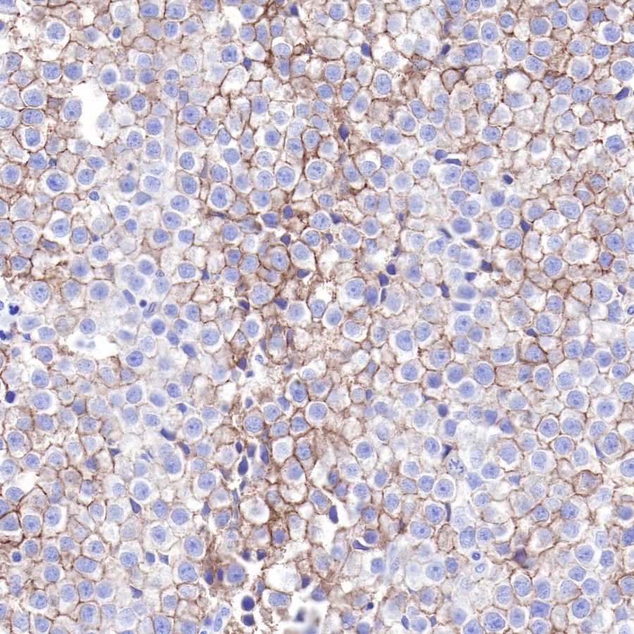Rabbit anti-CD117 Recombinant Monoclonal Antibody(125-51)