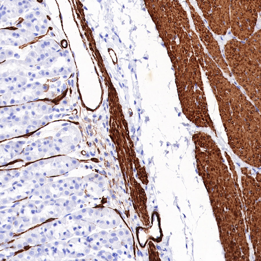 Rabbit anti-Myosin-11 Recombinant Monoclonal Antibody(188-112)