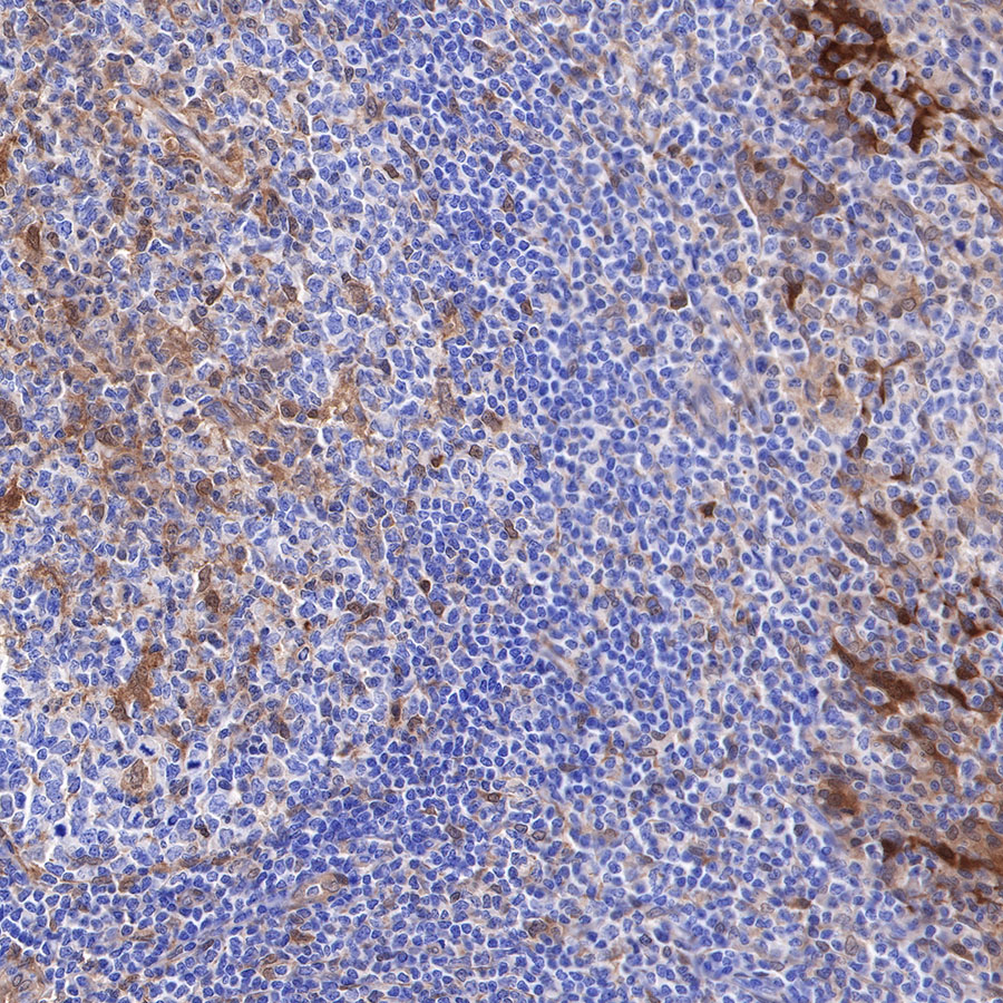 Rabbit anti-Galectin-3 Recombinant Monoclonal Antibody(370-111)