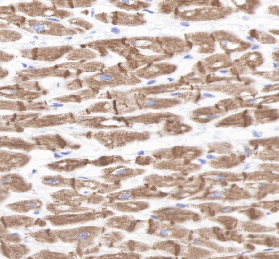 Rabbit anti-Desmin Recombiant Monoclonal Antibody(109-67)