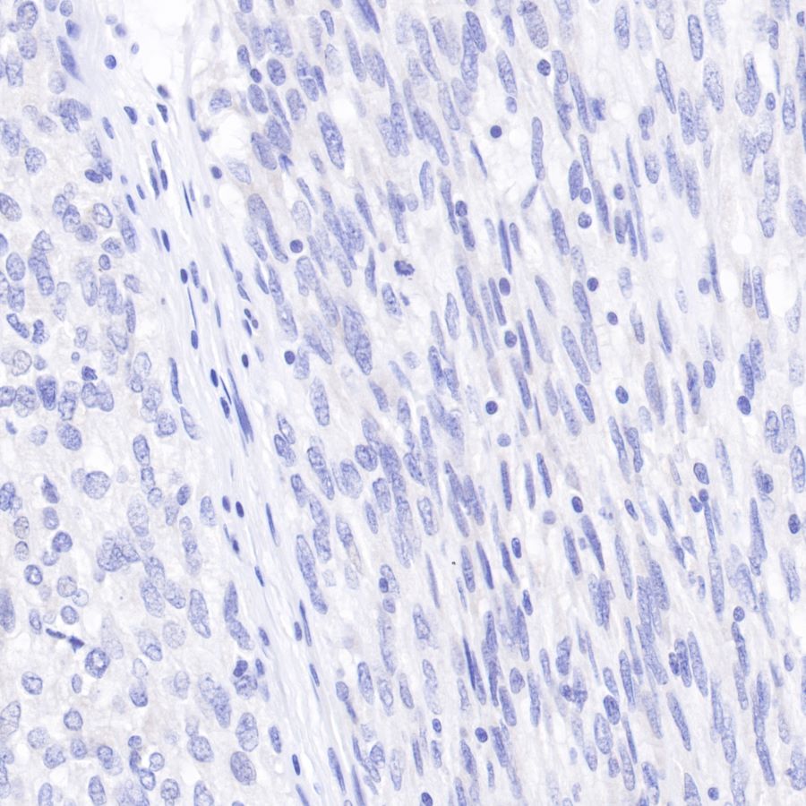 Rabbit anti-Desmin Recombiant Monoclonal Antibody(109-67)