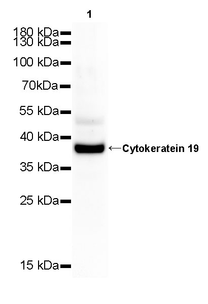 Rabbit anti-CytokeRatin 19 Recombiant Monoclonal Antibody(107-19)