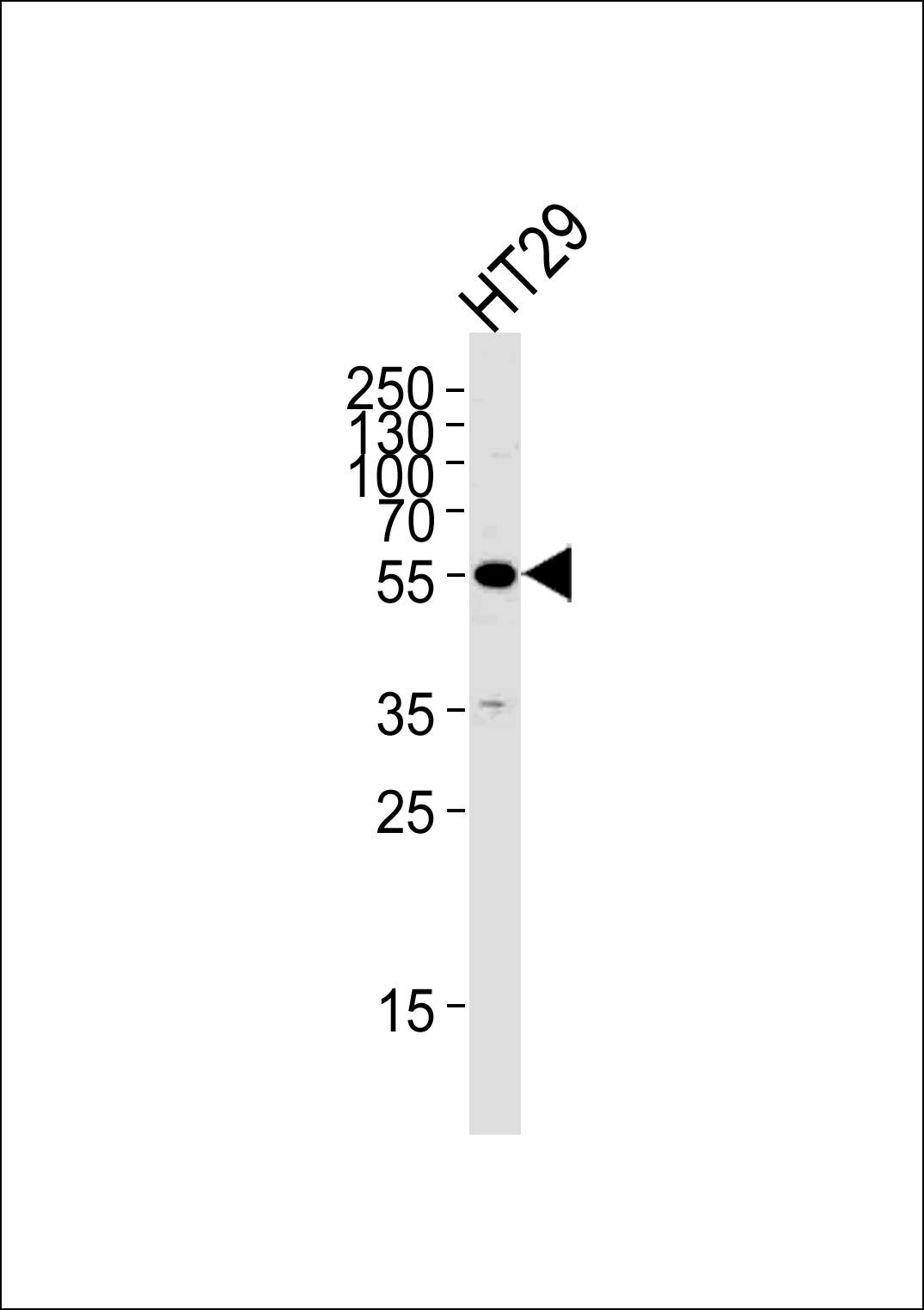 Mouse anti-TP53 Monoclonal Antibody(N-term)(1227CT355.106.153)