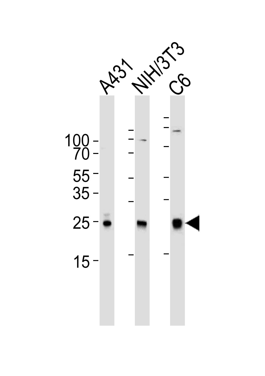 Mouse anti-RAC1 Monoclonal Antibody(1301CT276.121.104)