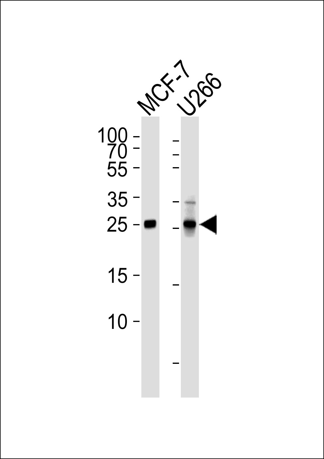 Mouse anti-CDKN1B Monoclonal Antibody(1373CT407.103.103)