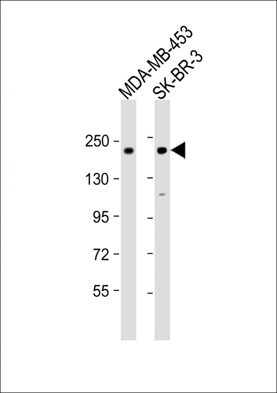 Rabbit anti-ERBB2 Polyclonal Antibody(Center S998)